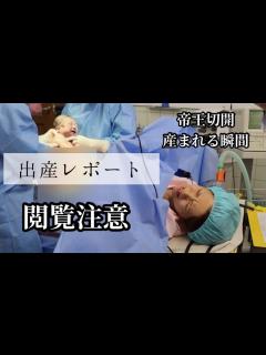 [x]赤ちゃんが生まれる瞬間。麻酔があまり効かない状態での予定帝王切開。手術シーン リモート出産 - YouTube